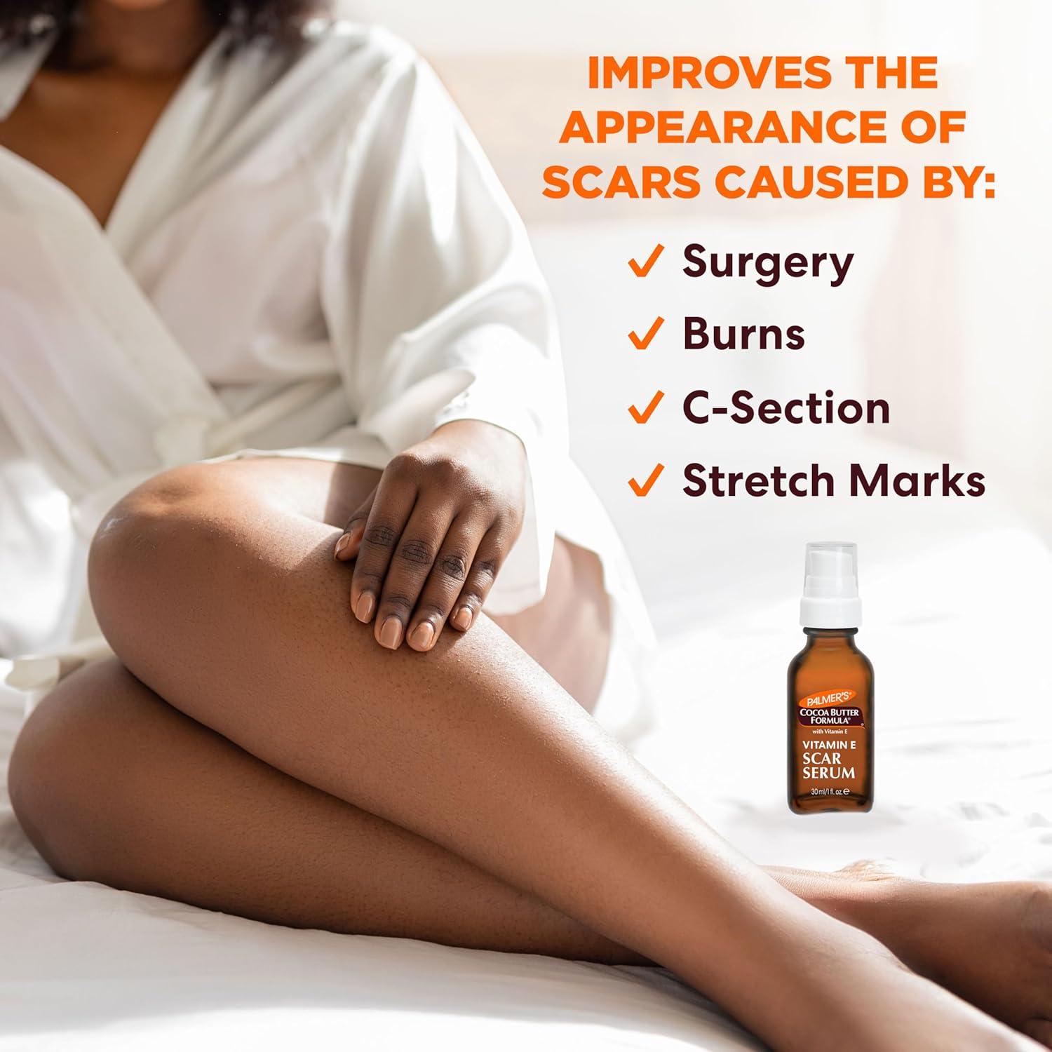 imagePalmers Cocoa Butter Formula Scar Serum Skin Brightening Oil for Face amp Body Concentrated Serum with Vitamin E Fragrance Free 1 Fl Oz