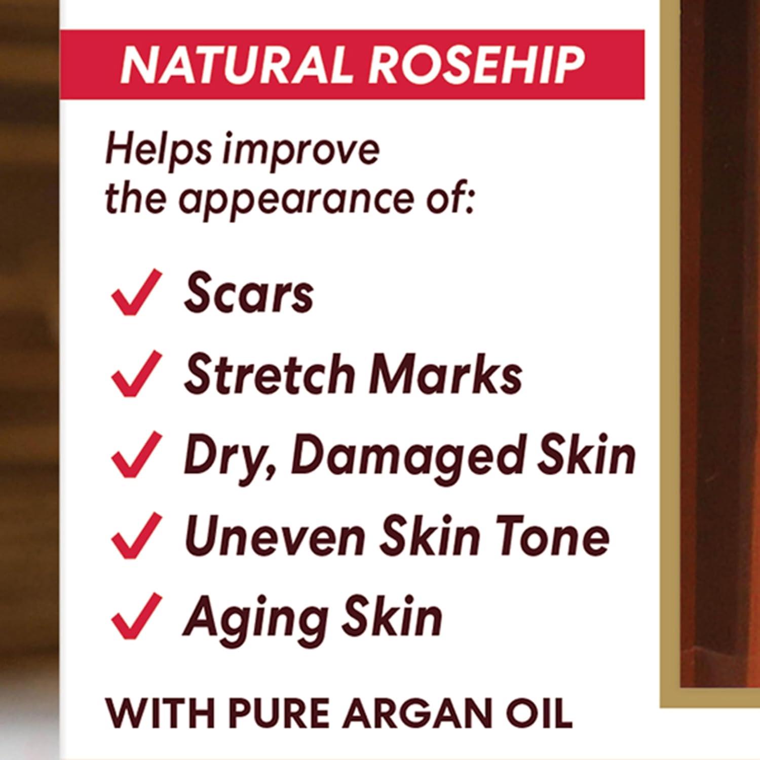 imagePalmers Cocoa Butter Formula Skin Therapy Moisturizing Body Oil with Vitamin E Rosehip Fragrance 51 Ounces51 Fl Oz Pack of 1