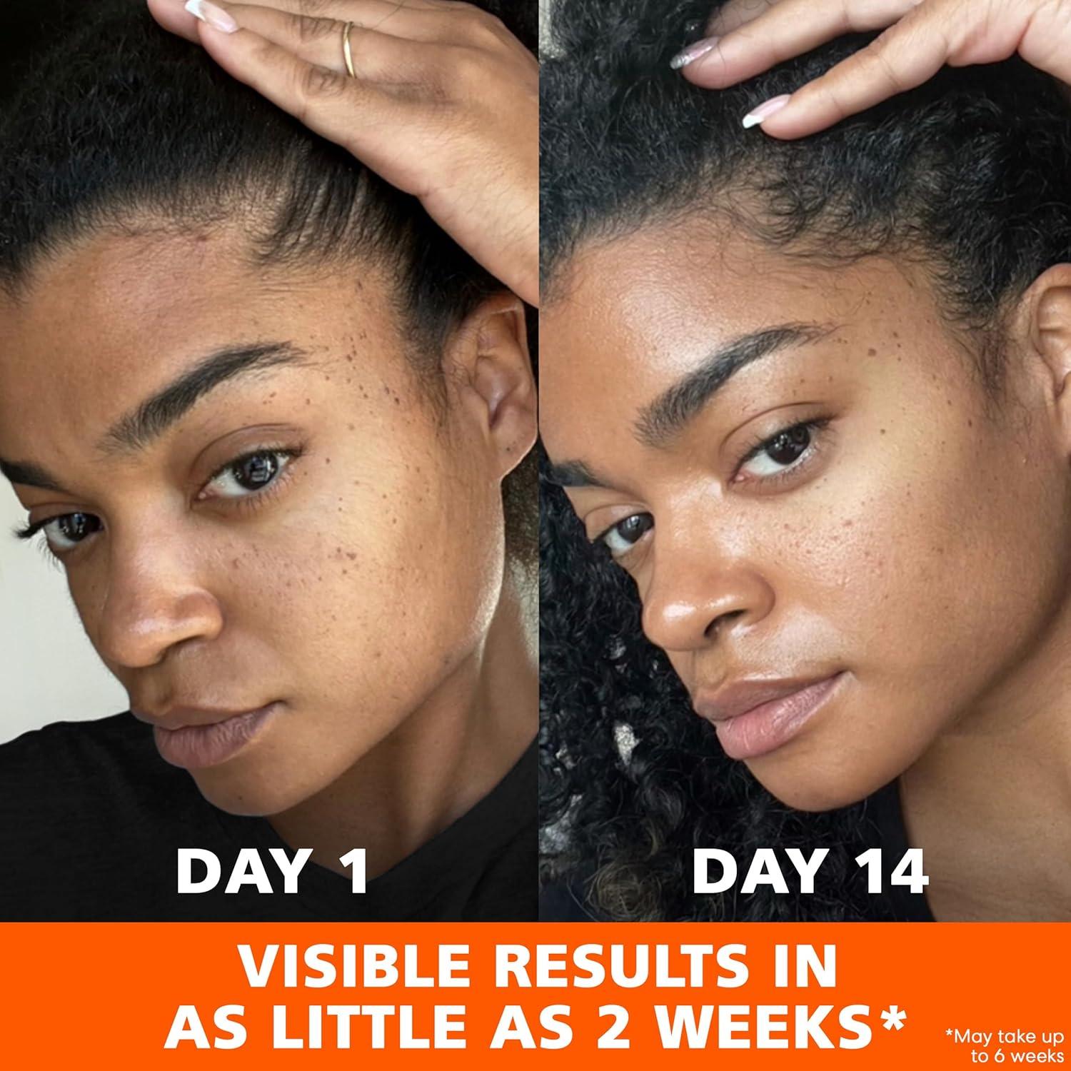 imagePalmers Skin Success AntiDark Spot Fade Cream with Vitamin E and Niacinamide for All Skin Types 27 Ounce27 Ounce Pack of 1